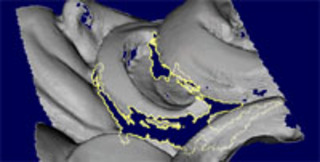 hole in David's hair